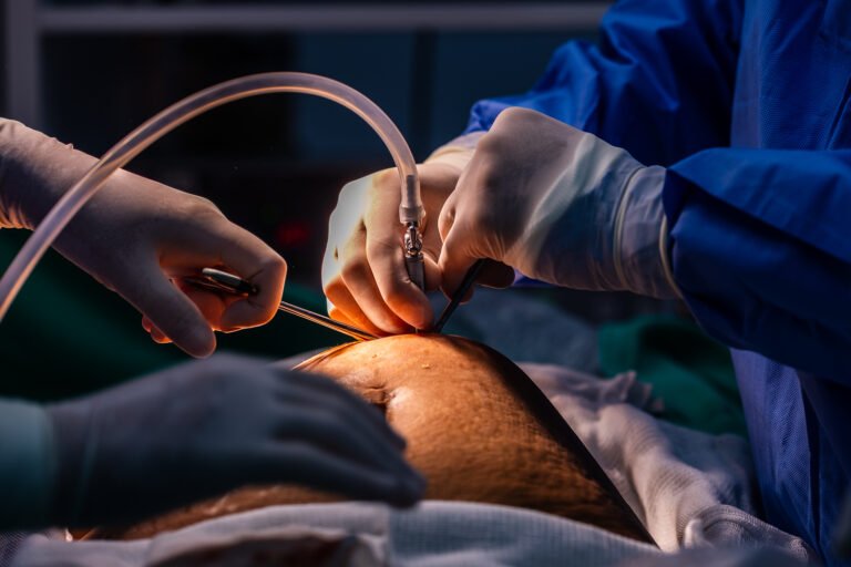 Santa Catarina amplia cirurgias bariátricas pelo SUS com novo serviço